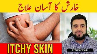 Itchy Skin: Kharish Ka Ilaj | Kharish Khatam Karne Ka Tarika | Khujli Ka Ilaaj | Khaarish Ka Elaj