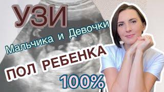 Узи мальчика и узи девочки, на 1,2 и 3 скрининге. На каком сроке лучше смотреть пол ребенка.