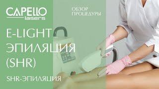 Обзор процедуры SHR-эпиляции на E-Light аппарате CAPELLO