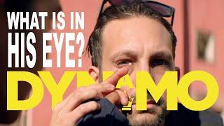 A woman pushes a mint out of Dynamo's eye