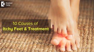 10 CAUSES OF ITCHY FEET: How to get relief ? Right Treatment - Dr. Urmila Nischal |Doctors' Circle