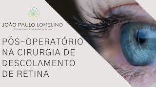 Pós operatório na Cirurgia de descolamento de Retina com Dr. João Paulo Lomelino