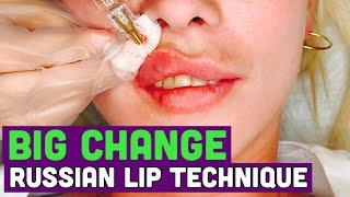 Russian Lips Time lapse! How to do Bigger Lips 2021