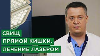 Лечение свища прямой кишки лазером / Свищ прямой кишки - что это?