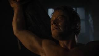 Game of Thrones Theon's poor leg (YTP)