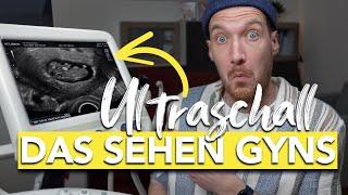 Was ist das? Ultraschall in der Schwangerschaft enträtselt I vom Embryo bis zum Baby