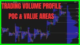 Should You Trade Volume Profile's Point of Control and Value Areas?