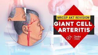 Giant Cell Arteritis | MRCGP AKT Revision | Dorky Docs