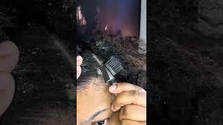 Dandruff scratching after braid take down  #dandruffscratching #naturalhair #mediumknotlessbraids