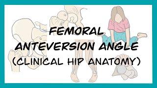 Femoral Anteversion and Retroversion Angles (Clinical Hip Anatomy)