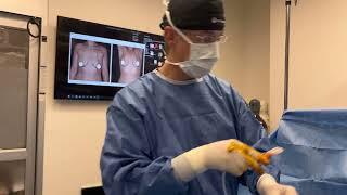 A 390cc breast augmentation with an anchor type breast lift with Dr 6ix | Six Surgery | Toronto