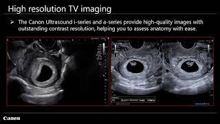 Canon Medical Ultrasound Women's Health Solutions