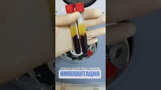 Тромбоциты ускоряют процесс заживления. Platelets accelerate the healing process.