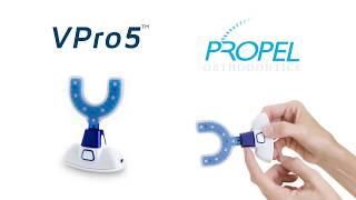 Propel VPro5 For Invisalign - How It Works!