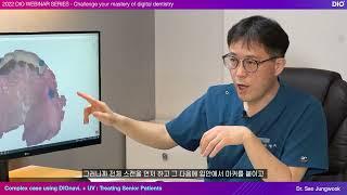 Complex case using DIOnavi. + UV : Treating Senior Patients by Dr. Jung-wook Seo