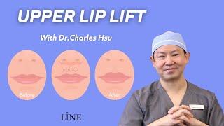 UPPER LIP LIFT with Dr. Charles Hsu - Line Plastic Surgery Center Los Angeles 인중성형 인터뷰/人中缩短手术 洛杉矶
