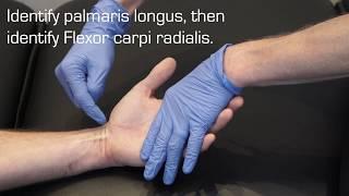 Injection Technique for Carpal Tunnel Syndrome