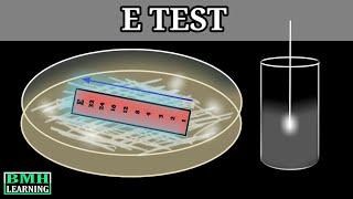 E Test |  E Test For Antibiotic Susceptibility | MIC Determination By E Test | Epsilometer Test |