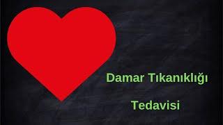 Damar Tıkanıklığı Tedavisi | Balon | Stent | Prof. Dr. Nihat Özer | Doktorundan Dinle