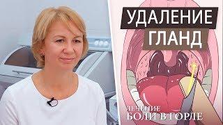 Удаление миндалин (гланды). Боль в горле. Тонзиллит