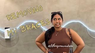 Removing my braces | Invisalign | How much does it cost?