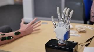 Improving the control of prosthetic hands