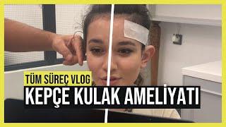 Kepçe Kulak Ameliyatını A dan Z ye Çektik - VLOG