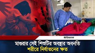 মাগুরার সেই শি/শুর অবস্থা আ/শ/ঙ্কা/জনক, পাশে বসে কাঁ/দ/ছেন মা | Magura Child | Ittefaq