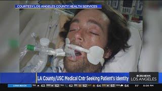 LAC+USC Medical Center seeking help in identifying unknown patient