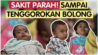 ANAK-ANAK INI SAKIT PARAH! SAMPAI TENGGOROKANNYA BOLONG! | MamaPapa.id