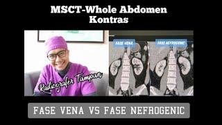 MSCT-Whole Abdomen Kontras (Contrast), Keunggulan Fase Nefrogenic / Fase 80 detik