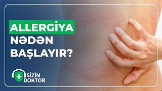 QİDA ALLERGİYASI ÖZÜNÜ NECƏ GÖSTƏRİR? - SİZİN DOKTOR - (05.09.2023)