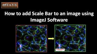 How to add Scale Bar to an image using ImageJ Software