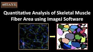 Quantitative Analysis of Skeletal Muscle Fiber Area using ImageJ Software