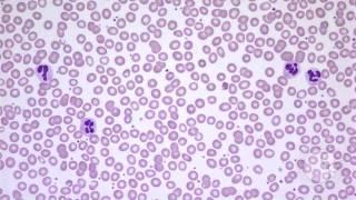 Haematology - Matters October 2016