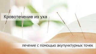 Кровотечение из уха