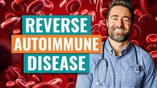 5 Warning Signs of Autoimmune Disease & How To REVERSE It