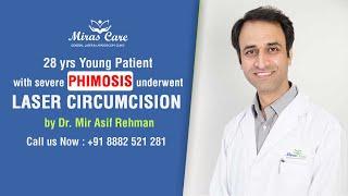 Painless Laser Circumcision Surgery for Severe Phimosis in Young Male Patient-Mirascare Clinic India