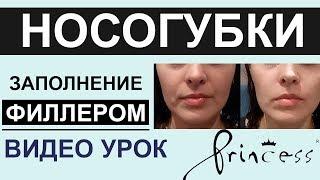 ЗАПОЛНЕНИЕ НОСОГУБОК  ПРИНЦЕСС ФИЛЛЕРОМ (контурная плстика носогубных складок)