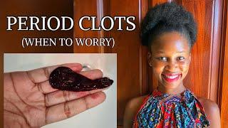 Period Clots | Menstrual Clots-Formation, Causes, Complications, Treatments & When to go to Hospital