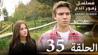 الحلقة 35 | مسلسل زهور الدم | مدبلج بالعربية | Kan Çiçekleri