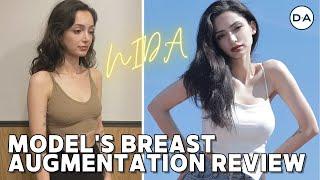 [Plastic Surgery Korea] Breast Augmentation Review From Model Nida