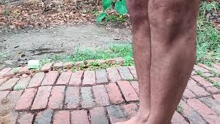 How can the deformity of Knock-knees be managed? Exercises of toe, ankle, foot, shape the knee joint