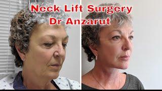 Neck lift surgery explained - everything you want to know about neck rejuvenation with Dr Anzarut