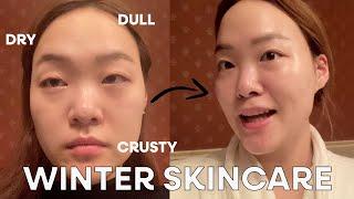 Skincare that's saving my ass lol | Winter Skincare