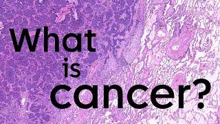 What is cancer and how does it start? | Cancer Research UK