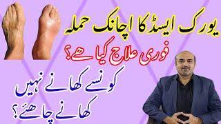 Acute Gout Attack | How To Manage Acute Gout | What Foods To Avoid In Chronic Gout | dr afzal