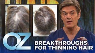 New Breakthroughs for Thinning Hair | Oz Health