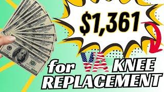 How To Obtain 60% For VA Claim - Knee Replacement Only!