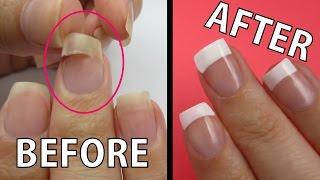 REPAIR A RIPPED NAIL FAST!